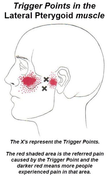 Lateral_Pterygoid-384x615