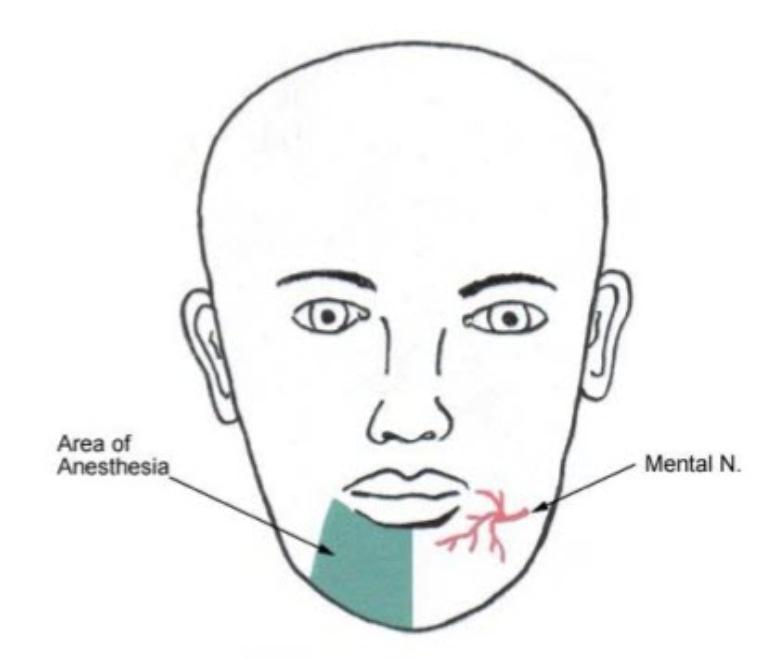 Mental Nerve Distribution