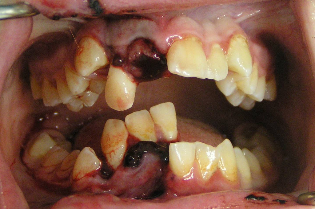 Dental_Trauma